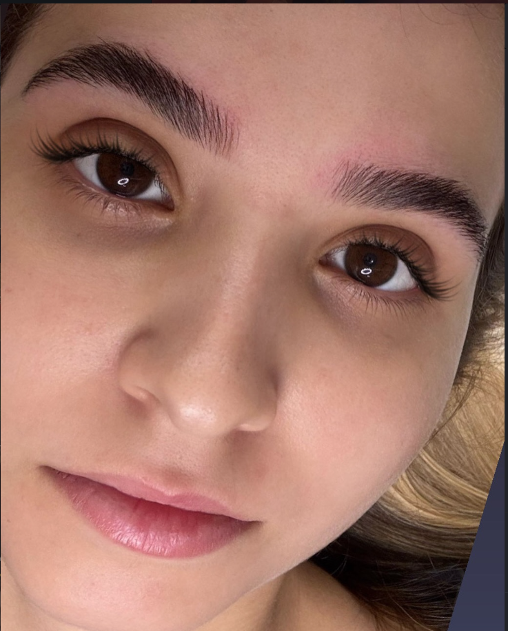 Resultado sobrancelhas — Flow Brows