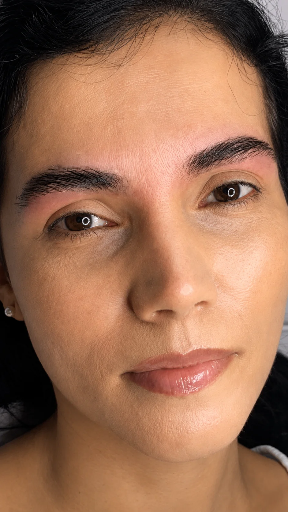 Resultado — Regeneração de Sobrancelhas feminina