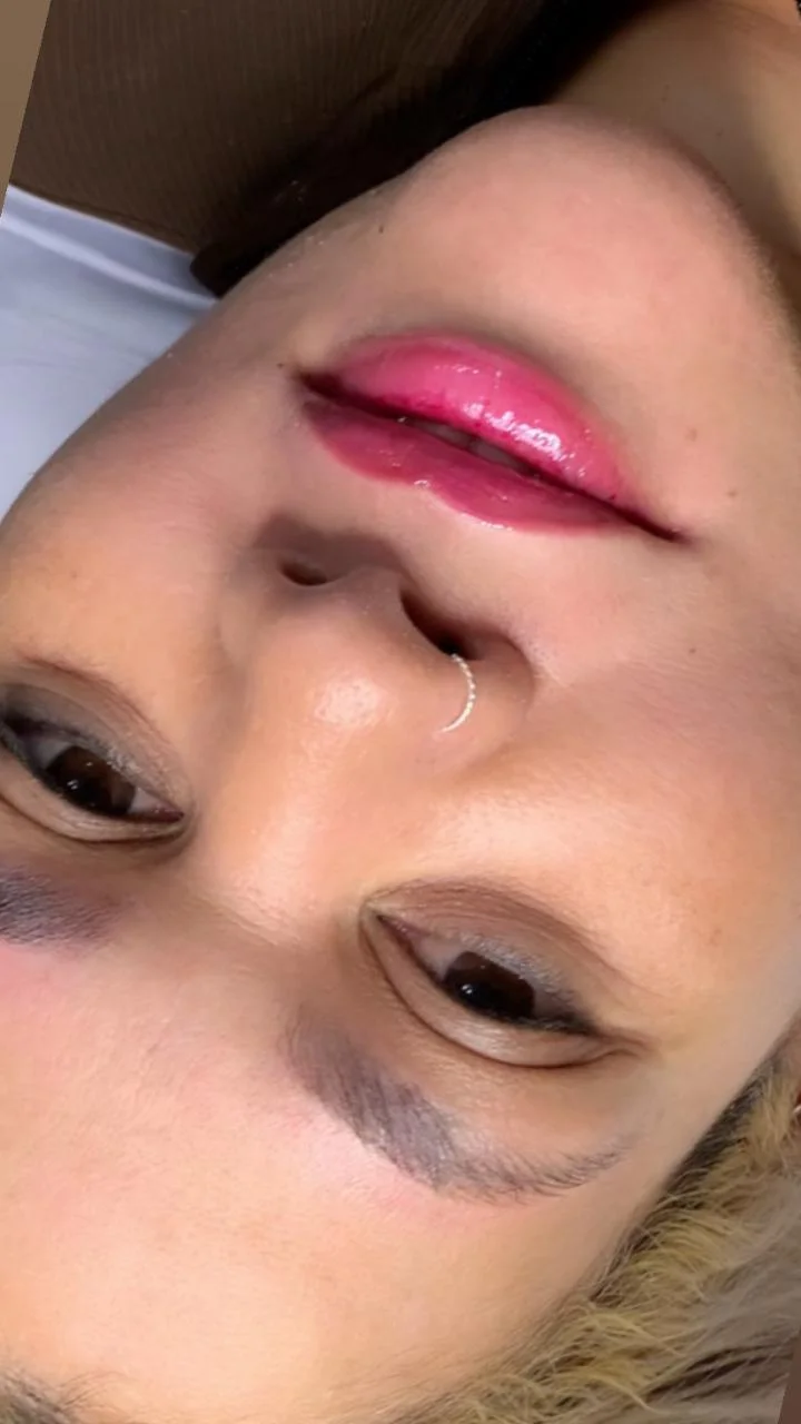Resultado — Revitalização Labial